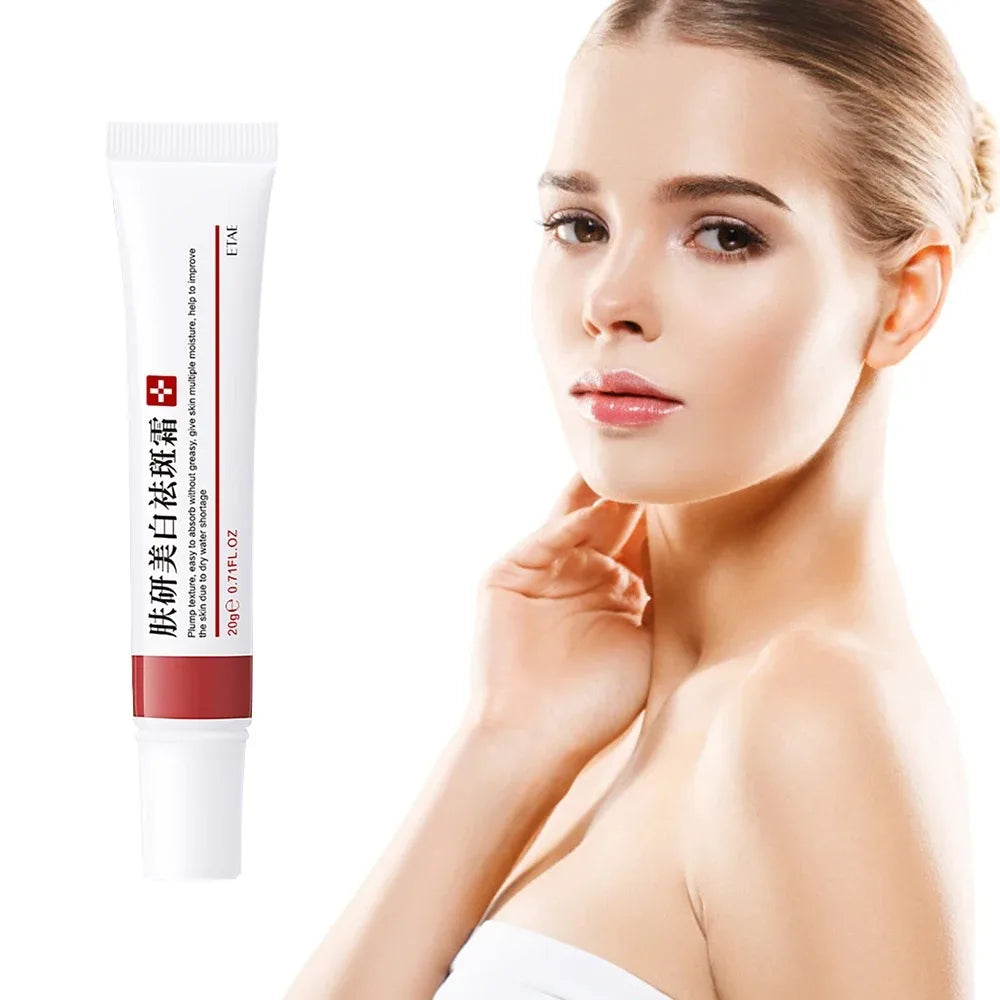 Güçlü Leke Açıcı Yüz Kremi – Melazma, Melanin ve Pigmentasyon Giderici, Nemlendirici Cilt Bakım Kremi 20g